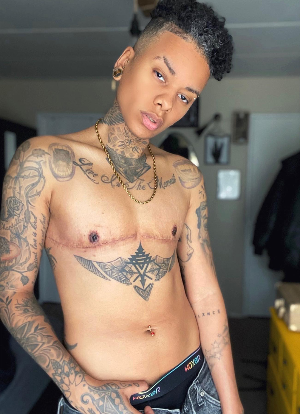 top surgery experience Kasey S