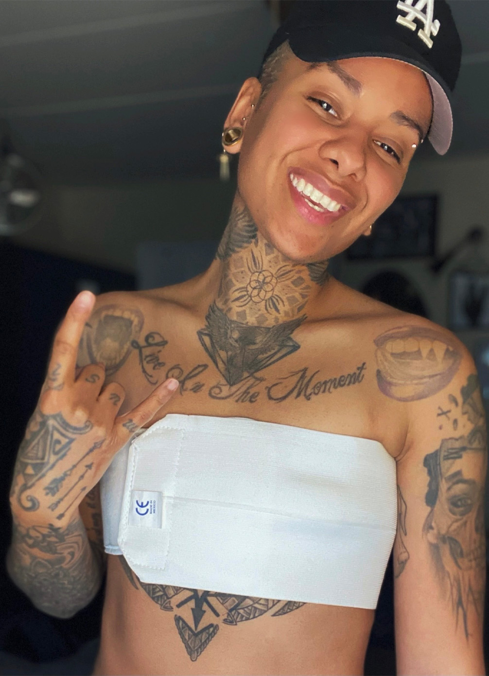 top surgery experience Kasey S